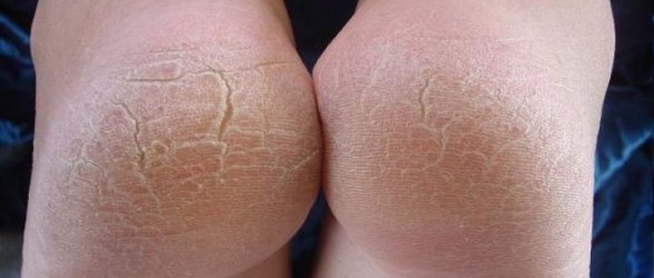 foot