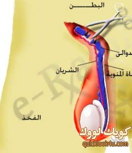 dwaly